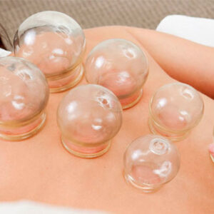 Corso di Coppettazione Milano 1 livello